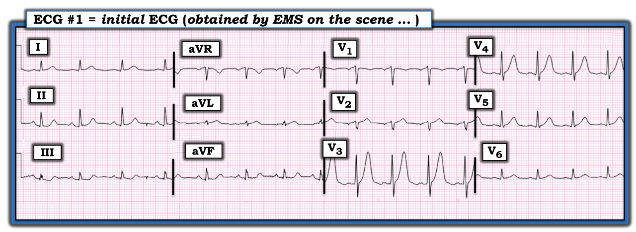 ECG Review Sept. 15, 2022 IM