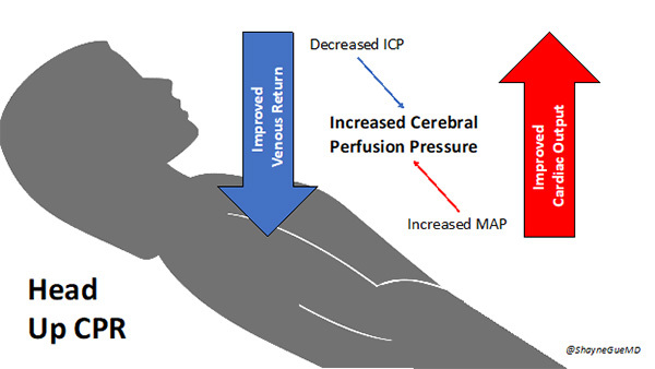 New and improved: CPR undergoes overhaul