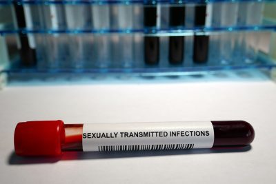 STI sample tube Getty Images 959020188