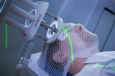 Brain radiotherapy Getty Images 108329638
