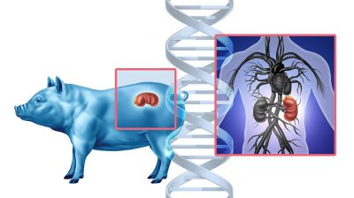 Xenotransplantation Getty Images 2159471852