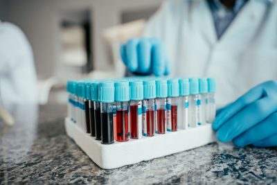 Blood collection tubes Getty Images 2166352695