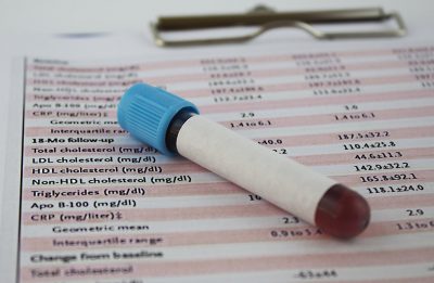 Cholesterol screening results Getty Images 1130755944