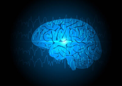 Seizure brain illustration Getty Images 1353162365