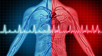 Afib illustration Getty Images 1208289144