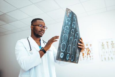Doctor looking at brain MRI Getty Images 1852704045