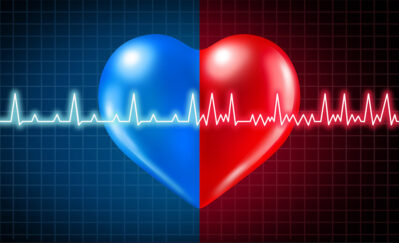 Afib graphic Getty Images 1182368517
