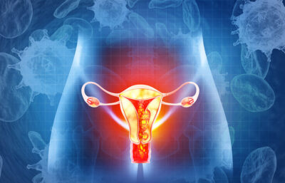 Endometrial cancer Getty Images 2027095193