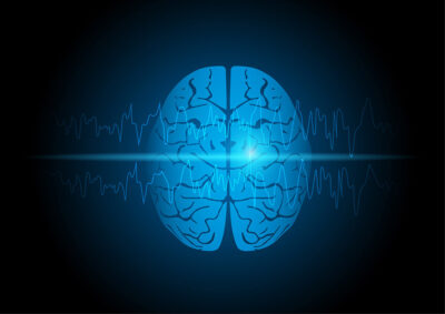 Brain EEG Getty Images 1304730300