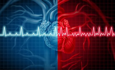 Afib illustration Getty Images 947331372