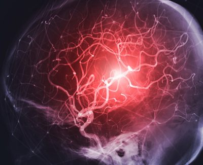 Cerebral arteries Getty Images 1473414849