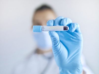 Doctor holding blood sample Getty Images 1324217043