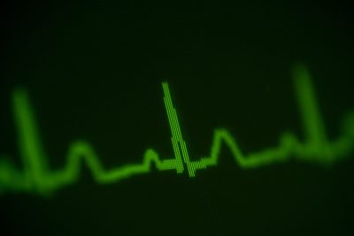 Sinus rhythm Getty Images 1277225265
