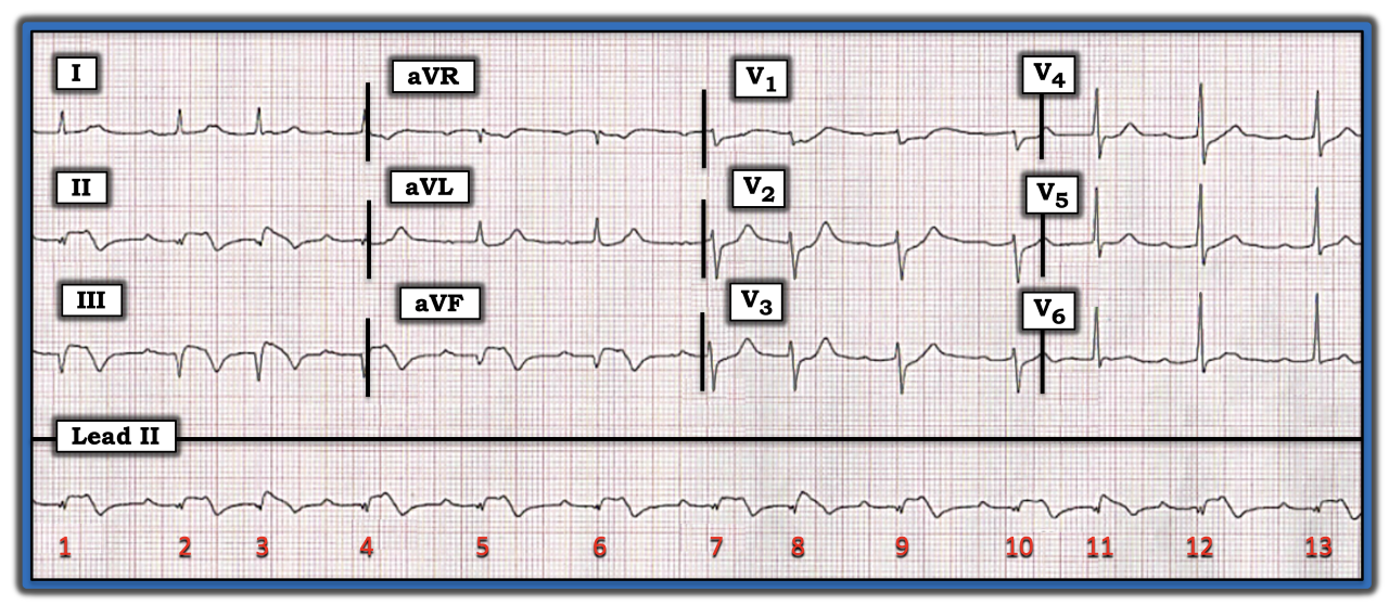 ECG Review August 15, 2022