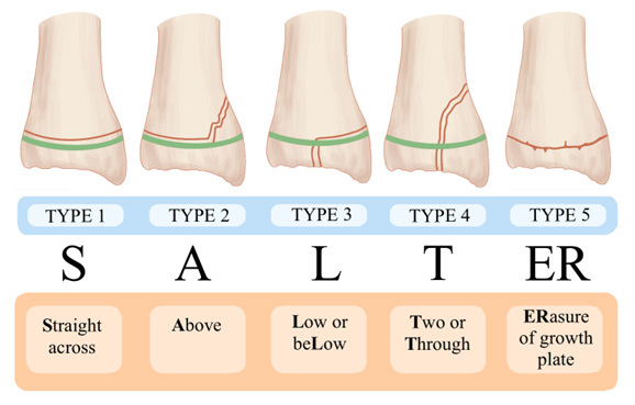 Evaluation And Management Of Elbow Injuries In The Relias Media