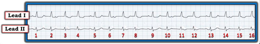 ECG IM 101524