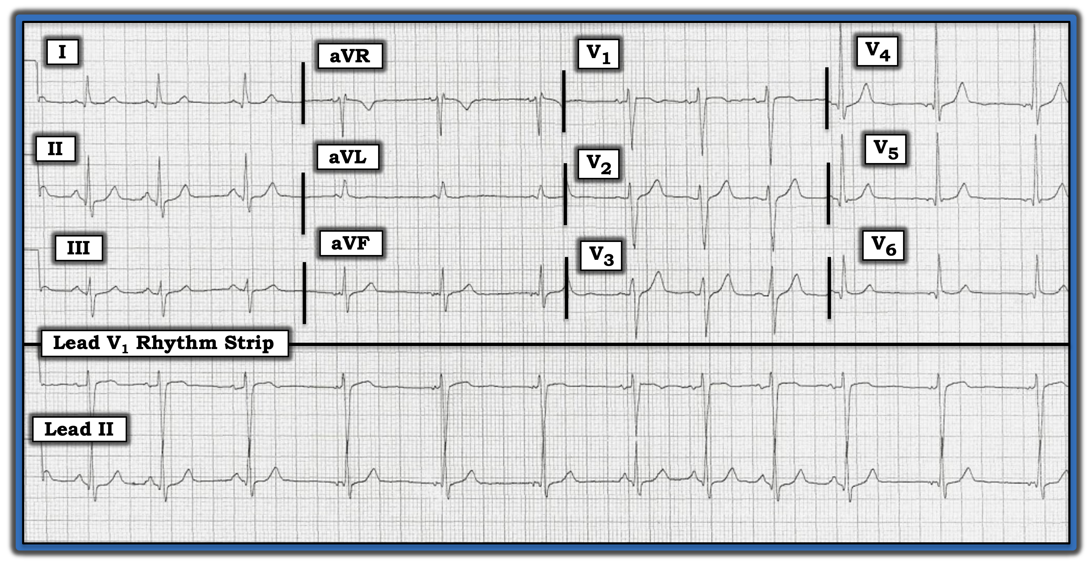 Oct. 15, 2023, IM ECG Review Figure